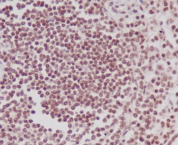 Phospho-POLR2A/POLR2A Rabbit Monoclonal Antibody
