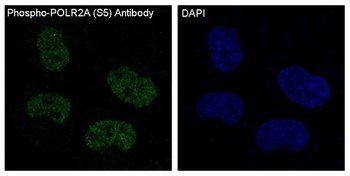 Phospho-POLR2A/POLR2A Rabbit Monoclonal Antibody