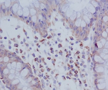 Phospho-PKR EIF2AK2/PKR Rabbit Monoclonal Antibody