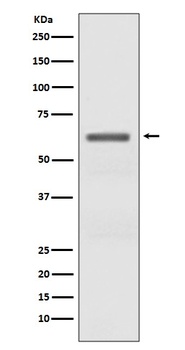Phospho-AMPK alpha PRKAA2/AMPK Rabbit Monoclonal Antibody