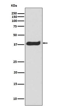 Phospho-LAT/LAT Rabbit Monoclonal Antibody