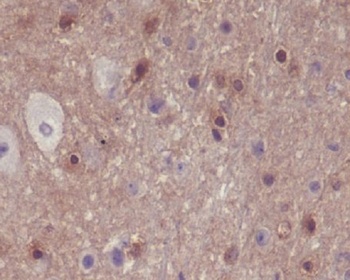 Phospho-PAK1/2/3 PAK3/PAK1 Rabbit Monoclonal Antibody