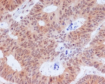 Phospho-EIF2S1/EIF2S1 Rabbit Monoclonal Antibody