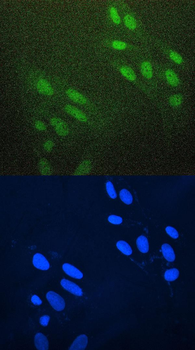 AREB6/ZEB1 Rabbit Polyclonal Antibody
