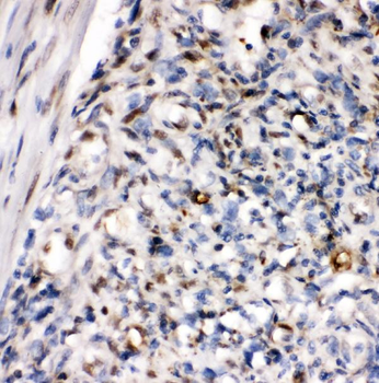 AREB6/ZEB1 Rabbit Polyclonal Antibody
