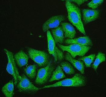 Cofilin 2/CFL2 Mouse Monoclonal Antibody