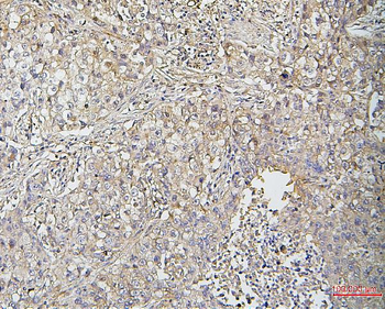 Cofilin 2/CFL2 Mouse Monoclonal Antibody