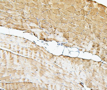 Cofilin 2/CFL2 Mouse Monoclonal Antibody