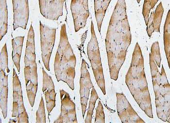 Cofilin 2/CFL2 Mouse Monoclonal Antibody