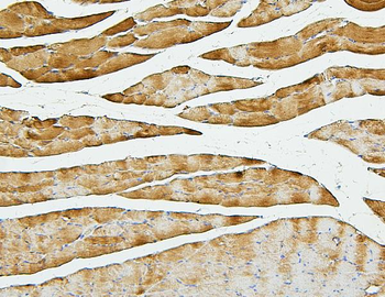Cofilin 2/CFL2 Mouse Monoclonal Antibody