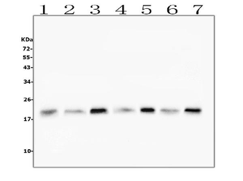 Cofilin 2/CFL2 Mouse Monoclonal Antibody