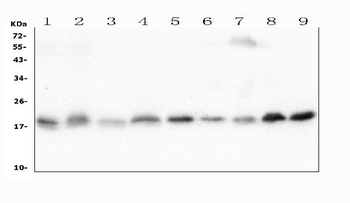 Cofilin 2/CFL2 Mouse Monoclonal Antibody