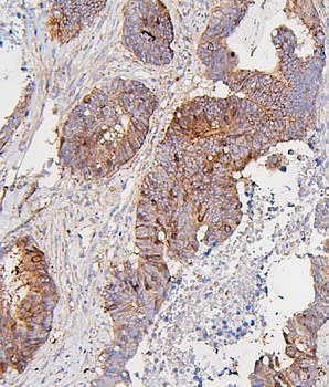CDK1 Mouse Monoclonal Antibody