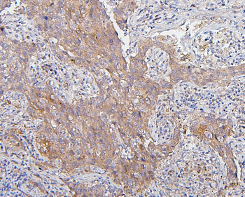 CDK1 Mouse Monoclonal Antibody