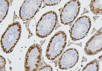 CDK1 Mouse Monoclonal Antibody