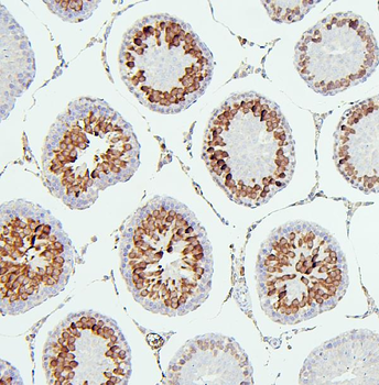 CDK1 Mouse Monoclonal Antibody