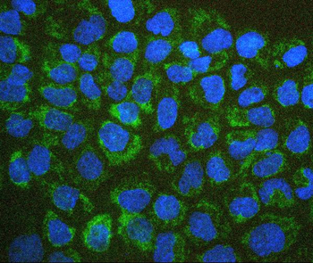 BAK/BAK1 Mouse Monoclonal Antibody