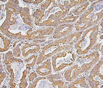 BAK/BAK1 Mouse Monoclonal Antibody