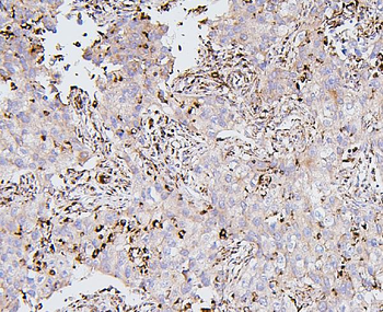BAK/BAK1 Mouse Monoclonal Antibody