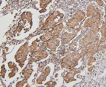 BAK/BAK1 Mouse Monoclonal Antibody