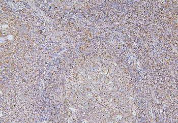 BAK/BAK1 Mouse Monoclonal Antibody