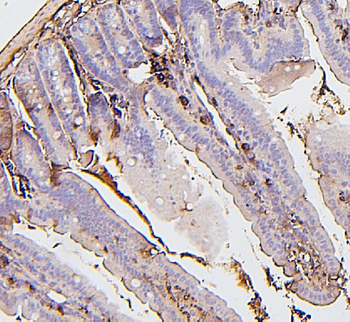BAK/BAK1 Mouse Monoclonal Antibody