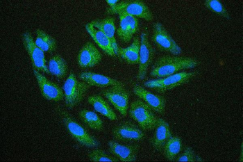 Hsp27/HSPB1 Mouse Monoclonal Antibody