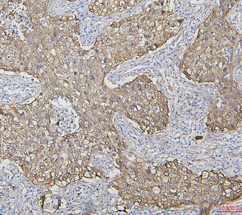 Hsp27/HSPB1 Mouse Monoclonal Antibody