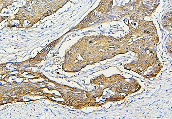Hsp27/HSPB1 Mouse Monoclonal Antibody