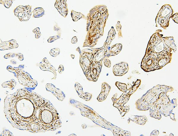 Hsp27/HSPB1 Mouse Monoclonal Antibody
