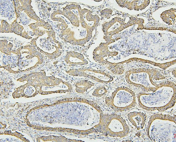 Hsp60/HSPD1 Mouse Monoclonal Antibody