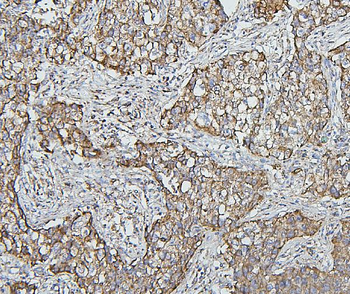 Hsp60/HSPD1 Mouse Monoclonal Antibody