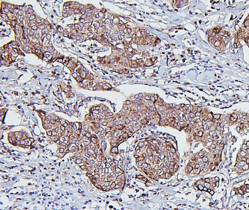Hsp60/HSPD1 Mouse Monoclonal Antibody