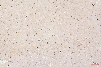HMGB1 Mouse Monoclonal Antibody