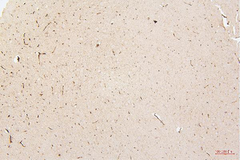 HMGB1 Mouse Monoclonal Antibody