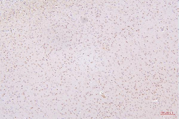 HMGB1 Mouse Monoclonal Antibody