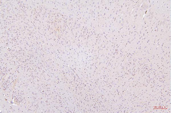 HMGB1 Mouse Monoclonal Antibody