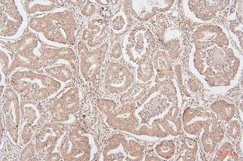 HMGB1 Mouse Monoclonal Antibody