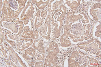 HMGB1 Mouse Monoclonal Antibody