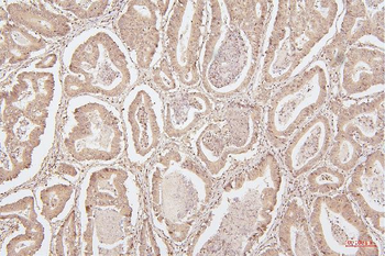 HMGB1 Mouse Monoclonal Antibody