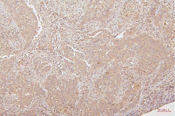 HMGB1 Mouse Monoclonal Antibody
