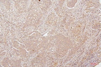 HMGB1 Mouse Monoclonal Antibody