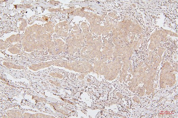 HMGB1 Mouse Monoclonal Antibody