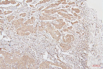 HMGB1 Mouse Monoclonal Antibody
