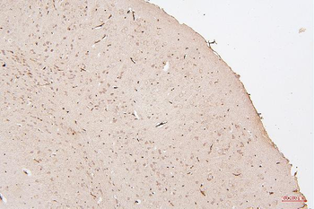 HMGB1 Mouse Monoclonal Antibody