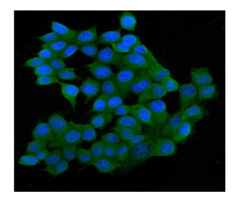 SQSTM1/p62 Mouse Monoclonal Antibody