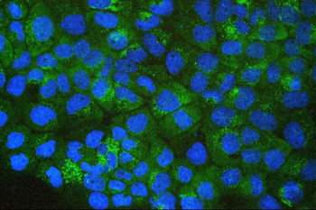 SQSTM1/p62 Mouse Monoclonal Antibody
