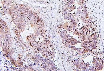SQSTM1/p62 Mouse Monoclonal Antibody