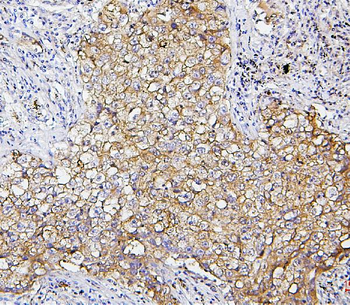 SQSTM1/p62 Mouse Monoclonal Antibody