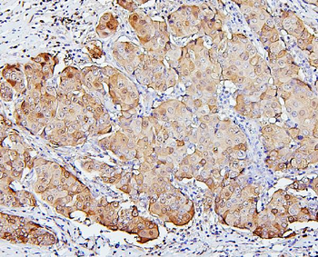 SQSTM1/p62 Mouse Monoclonal Antibody